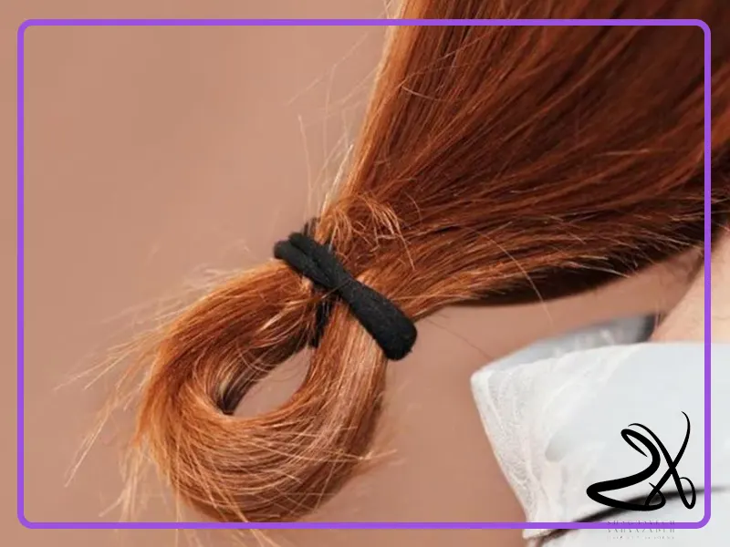 روش‌های قطعی جلوگیری از موخوره